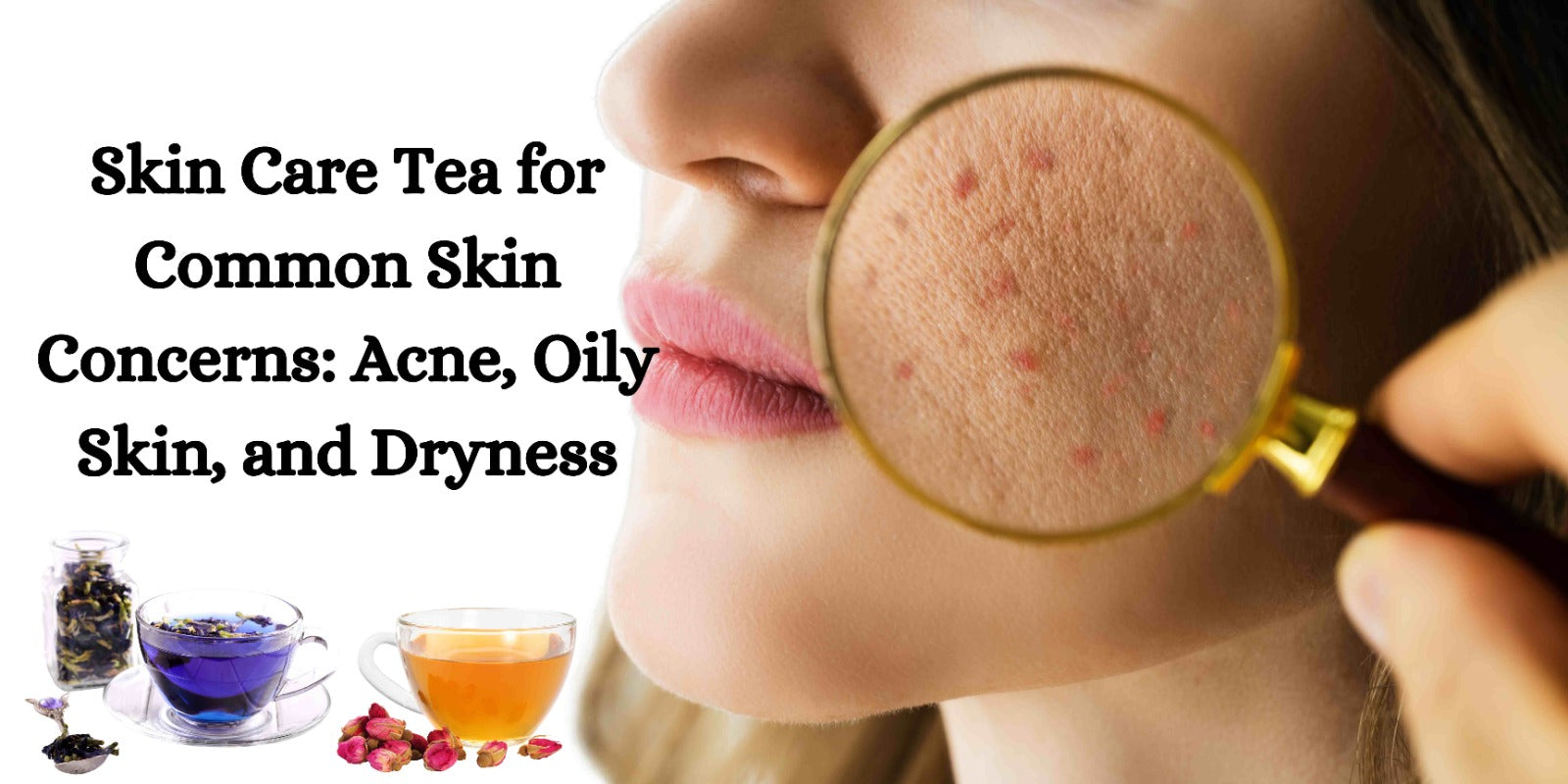 Skin Care Tea for Common Skin Concerns: Acne, Oily Skin, and Dryness
